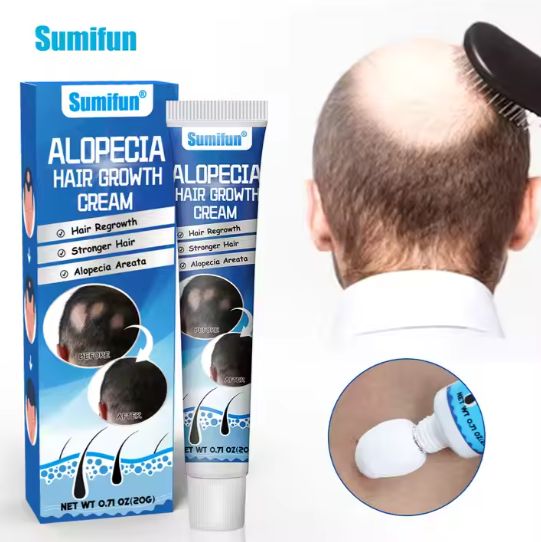 Reduces Hair Loss | Sumifun Hair Growth Cream ORIGINAL | Stronger Hair 100%
