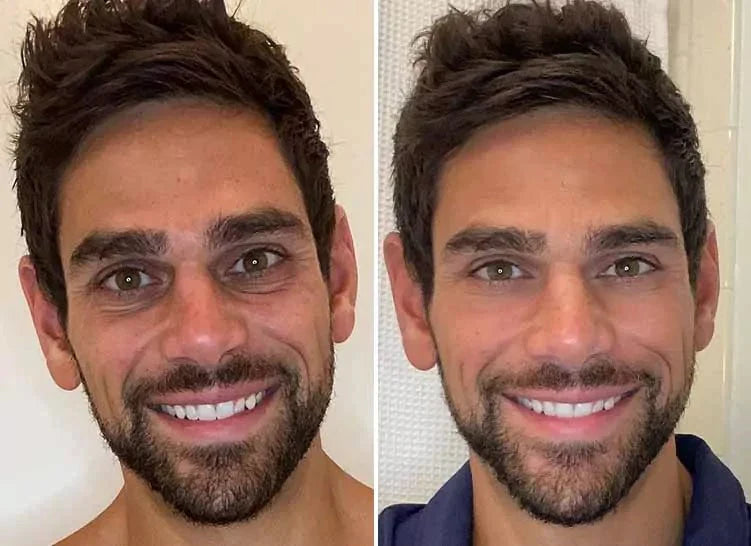 SAAM - Young & Radiance Serum (Original)