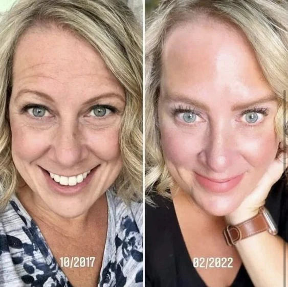 SAAM - Young & Radiance Serum (Original)